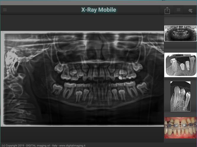 X Ray Mobile 2.0 APK