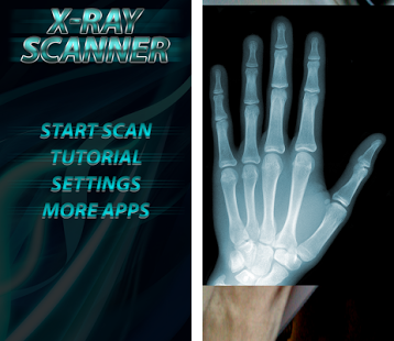 X Ray Mobile 2.0 APK