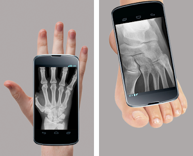 X Ray Mobile 2.0 APK